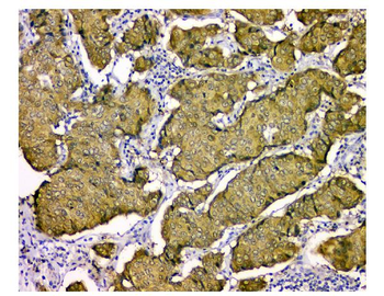 Anti-STUB1 Antibody (monoclonal, 13I8)
