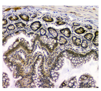 Anti-STUB1 Antibody (monoclonal, 13I8)