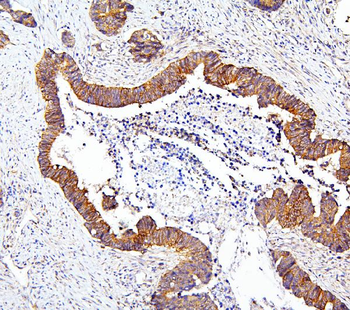 mTOR/MTOR Rabbit Polyclonal Antibody