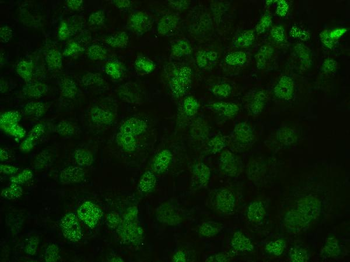 Anti-MECP2 Antibody