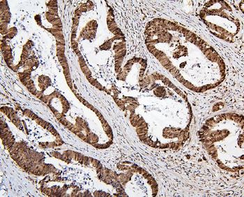 Anti-MECP2 Antibody
