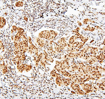 Anti-MECP2 Antibody