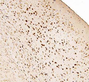 Anti-MECP2 Antibody