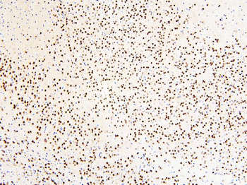 Anti-MECP2 Antibody
