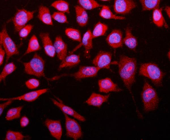 SMAD2 Antibody