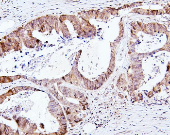 SMAD2 Antibody