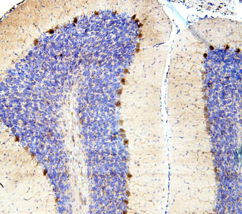 SMAD2 Antibody