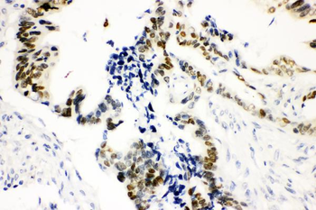Anti-SOX9 Antibody