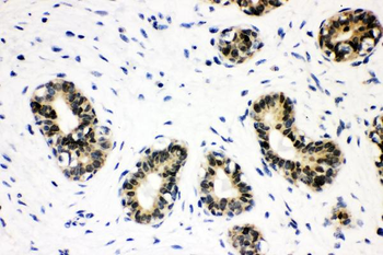 Anti-SOX9 Antibody