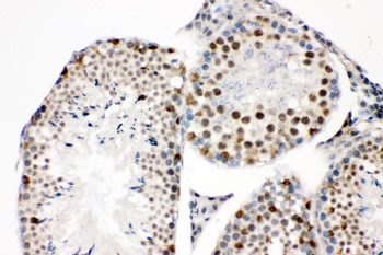 Anti-SOX9 Antibody