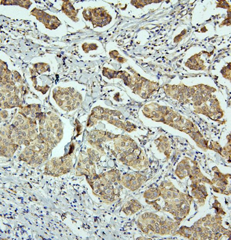 Anti-RET Antibody
