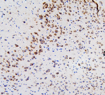 Anti-RET Antibody