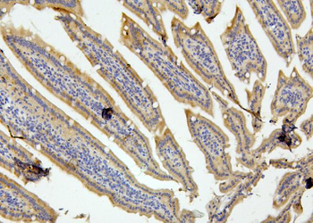 Anti-RET Antibody