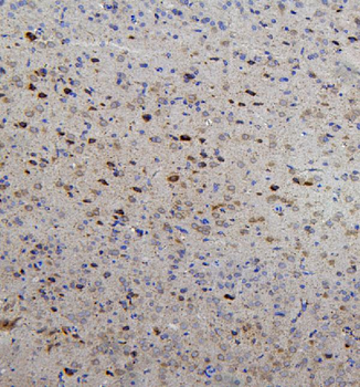 Anti-RET Antibody