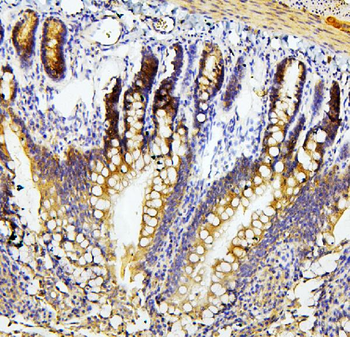 Anti-RET Antibody