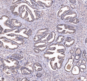 CD47 Rabbit Polyclonal Antibody