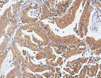 Anti-CDK5 Antibody