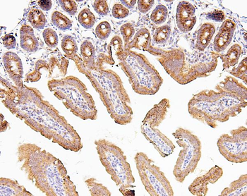 Anti-CDK5 Antibody