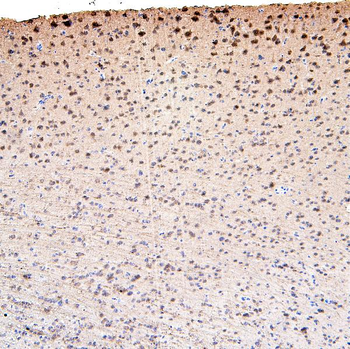 Anti-CDK5 Antibody