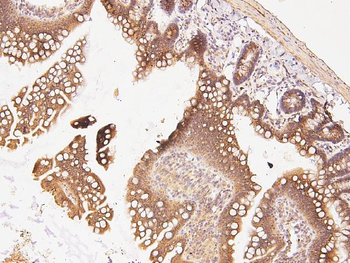 Anti-CDK5 Antibody