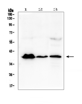 Anti-MR1 Antibody