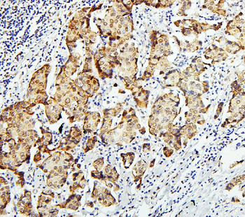 Anti-Zinc finger protein GLI2 GLI2 Antibody