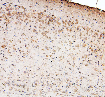 Anti-Zinc finger protein GLI2 GLI2 Antibody