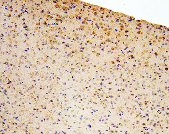 Anti-Zinc finger protein GLI2 GLI2 Antibody