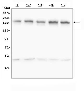 Anti-Zinc finger protein GLI2 GLI2 Antibody
