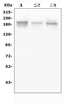 Anti-Zinc finger protein GLI2 GLI2 Antibody
