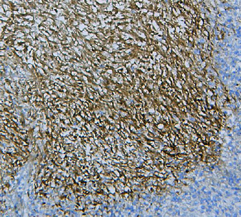 Anti-WNT4 Antibody