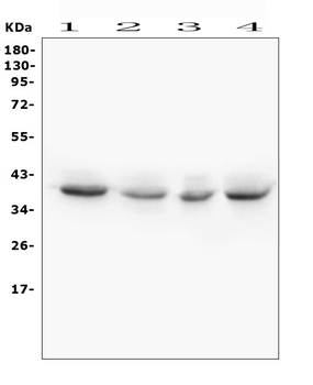 Anti-WNT4 Antibody