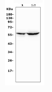 Cytochrome P450 2A6/CYP2A6 Antibody
