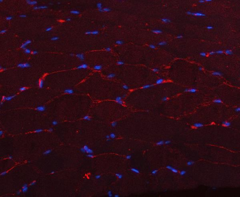 Caveolin-3/CAV3 Antibody