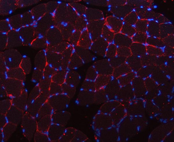 Caveolin-3/CAV3 Antibody
