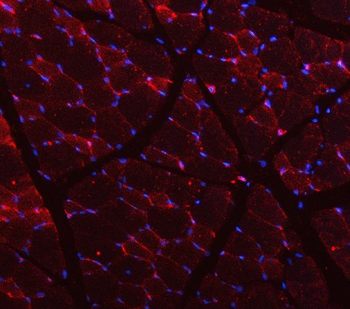 Caveolin-3/CAV3 Antibody
