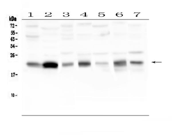 Caveolin-3/CAV3 Antibody