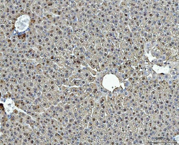 liver Arginase/ARG1 Antibody