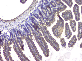 Anti-HDAC5 Antibody