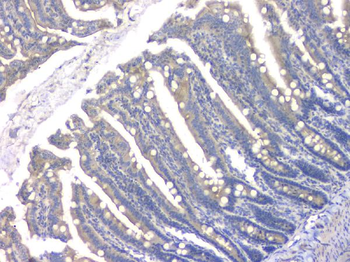 Anti-HDAC5 Antibody