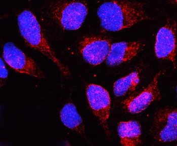 Anti-Lamin B Receptor/LBR Antibody