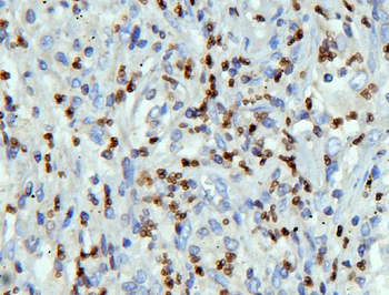Anti-Lamin B Receptor/LBR Antibody
