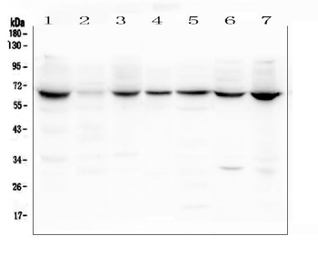 Anti-Lamin B Receptor/LBR Antibody