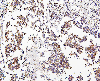 Anti-CRB1 Antibody