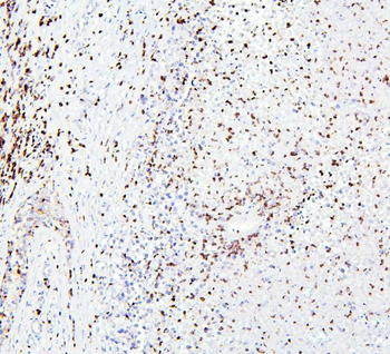 Anti-CRB1 Antibody