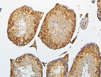 Anti-CRB1 Antibody