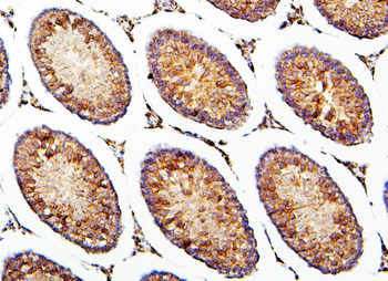 Anti-CRB1 Antibody