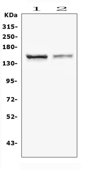 Anti-CRB1 Antibody