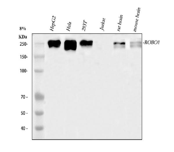 ROBO1 Rabbit Polyclonal Antibody