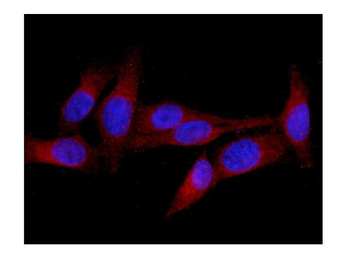 Anti-MID1 Antibody